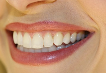 Cosmetic Dentistry Featured | Welcome Smile Dental | Calgary Downtown Dentist | Calgary AB