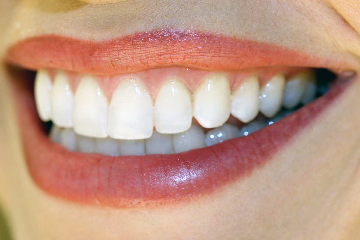 Beautiful Smile | Welcome Smile Dental | Calgary Dentist