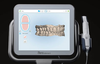 iTero Element | Welcome Smile Dental | Calgary Downtown Dentist | Calgary AB