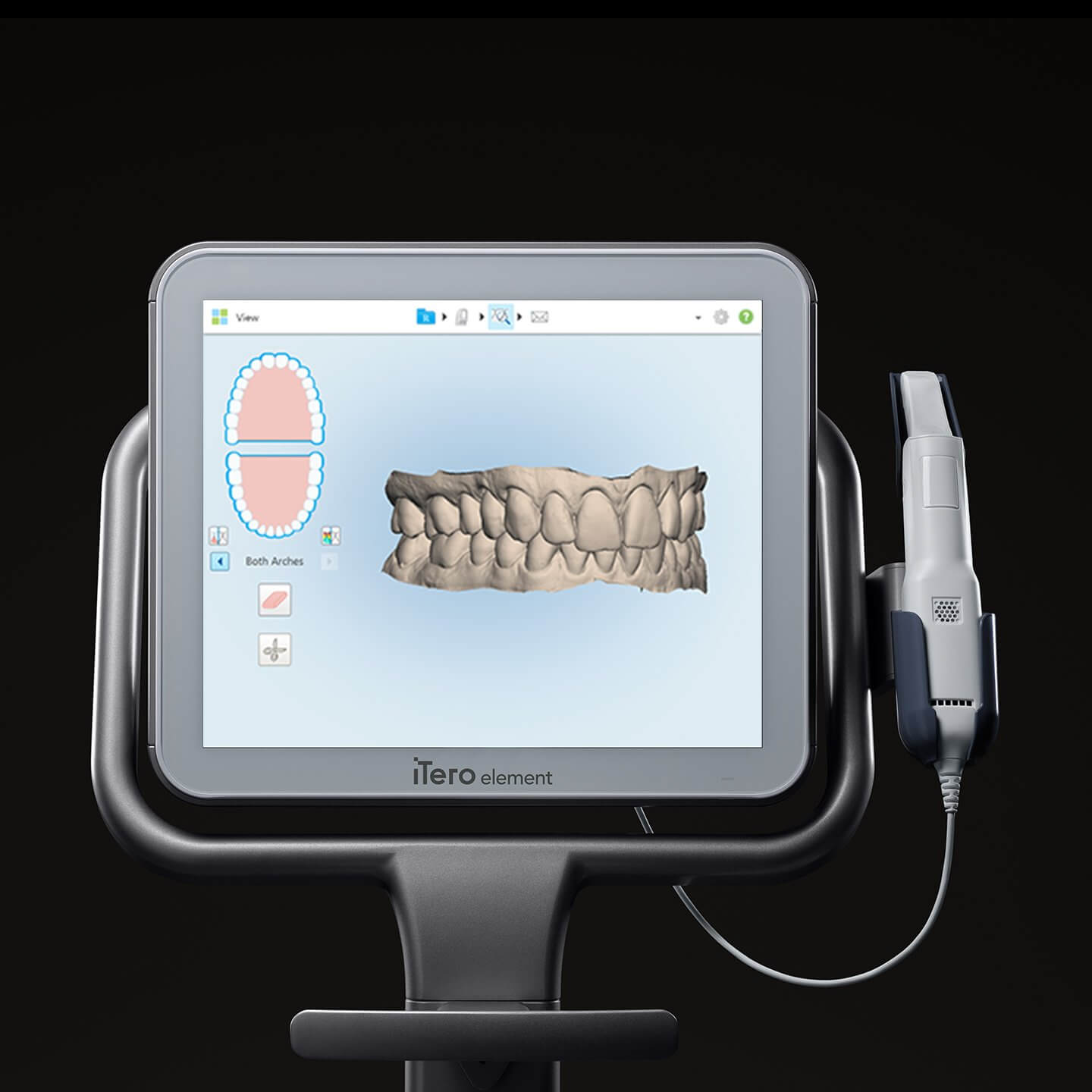 iTero Element | Welcome Smile Dental | Calgary Downtown Dentist | Calgary AB